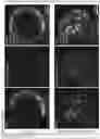 Fig. 42 - Culture Method for Organoids