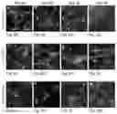 Fig. 09 - In vitro methods of differentiating stem cells into neurons and neurons generated using the same