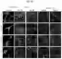 Fig. 22 - In vitro methods of differentiating stem cells into neurons and neurons generated using the same