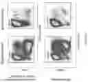 Fig. 12 - Process for generation, identification and isolation of human pluripotent stem cell-derived cardiomyocytes and cardiomyocyte subpopulations