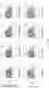 Fig. 23 - Process for generation, identification and isolation of human pluripotent stem cell-derived cardiomyocytes and cardiomyocyte subpopulations