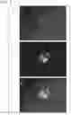 Fig. 06 - Reagent for differentiating somatic cells into alveolar epithelial cells, and use of said reagent