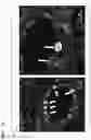 Fig. 11 - Reagent for differentiating somatic cells into alveolar epithelial cells, and use of said reagent
