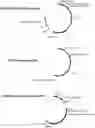 Fig. 01 - VECTORS WITH PROMOTER AND ENHANCER COMBINATIONS FOR TREATING PHENYLKETONURIA