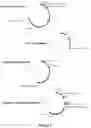 Fig. 03 - VECTORS WITH PROMOTER AND ENHANCER COMBINATIONS FOR TREATING PHENYLKETONURIA