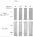 Fig. 04 - Method and device of using aqueous two-phase systems (ATPS) for enhancing diagnostics for dental and oral diseases