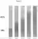 Fig. 06 - Method and device of using aqueous two-phase systems (ATPS) for enhancing diagnostics for dental and oral diseases