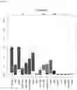 Fig. 09 - Detecting gastrointestinal neoplasms