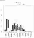 Fig. 70 - Detecting gastrointestinal neoplasms