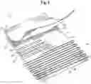 Fig. 03 - Knitted components reinforced with high tenacity yarn