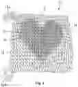 Fig. 02 - SEQUENTIALLY COLORED LOOPY YARN AND METHOD OF KNITTING NON-RANDOM DISCREET DESIGNS