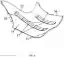 Fig. 07 - Centrifugal impeller