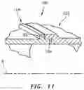 Fig. 09 - Pre-diffuser for a gas turbine engine