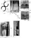 Fig. 02 - Device for reel-less spooling of hoses, flexible pipes and cables