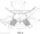 Fig. 07 - Air-cooled condenser system