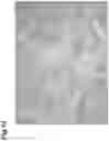 Fig. 15 - OBSERVATION TARGET OBJECT COVER, CONTAINER FOR INTERFERENCE OBSERVATION, INTERFERENCE OBSERVATION DEVICE, AND INTERFERENCE OBSERVATION METHOD