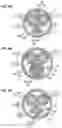 Fig. 07 - Sensor device, cable with sensor, and composite cable