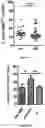Fig. 02 - METHODS FOR DETECTING, ASSESSING SEVERITY AND TREATING MULTIPLE SCLEROSIS