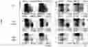 Fig. 08 - METHODS FOR DETECTING, ASSESSING SEVERITY AND TREATING MULTIPLE SCLEROSIS
