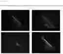 Fig. 12 - COMPOSITIONS AND METHODS FOR DETECTING AND TREATING PATHOLOGICAL FIBROBLAST CELLS