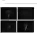 Fig. 13 - COMPOSITIONS AND METHODS FOR DETECTING AND TREATING PATHOLOGICAL FIBROBLAST CELLS