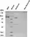 Fig. 01 - Nucleic acid encoding PCSK9 antibody