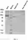 Fig. 02 - Nucleic acid encoding PCSK9 antibody