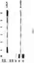 Fig. 08 - Nucleic acid encoding PCSK9 antibody