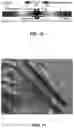 Fig. 10 - Encapsulation methods for fluid-communicating magnetoelastic sensors