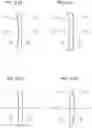 Fig. 09 - Method for corrective lens and corrective lens