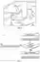 Fig. 06 - Systems and methods for shearing adjustment of a dental aligner cutting tool
