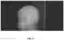 Fig. 07 - Systems and methods for determining scanning parameter in imaging