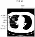 Fig. 48 - CONTROL METHOD AND RECORDING MEDIUM
