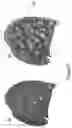 Fig. 07 - A METHOD AND APPARATUS FOR MAPPING AT LEAST PART OF A STRUCTURE IN AN IMAGE OF AT LEAST PART OF A BODY OF A SUBJECT