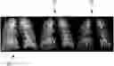 Fig. 01 - System and method for assessing a pulmonary image