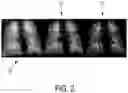 Fig. 03 - System and method for assessing a pulmonary image