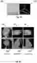 Fig. 04 - Autonomous segmentation of contrast filled coronary artery vessels on computed tomography images