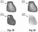 Fig. 05 - Autonomous segmentation of contrast filled coronary artery vessels on computed tomography images