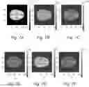 Fig. 10 - Learning-assisted multi-modality dielectric imaging