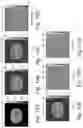 Fig. 15 - Learning-assisted multi-modality dielectric imaging
