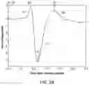 Fig. 07 - Methods and magnetic imaging devices to inventory human brain cortical function