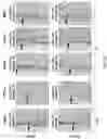 Fig. 45 - Methods and magnetic imaging devices to inventory human brain cortical function