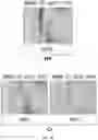 Fig. 49 - Methods and magnetic imaging devices to inventory human brain cortical function