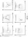 Fig. 16 - Intelligent data augmentation for supervised anomaly detection associated with a cyber-physical system