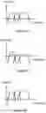 Fig. 03 - Enhanced sound perception via regulated vibration