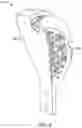 Fig. 04 - Device for picking fruit having an improved robot arm