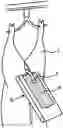 Fig. 01 - Method and device for detaching and enclosing the outer end of the rectum of a carcass