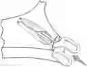 Fig. 01 - Method for inserting and removing clothing insert pads