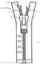 Fig. 04 - A Method And A System For Detection Of Characteristics Of A Fastener Of An Item Of Apparel