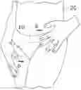 Fig. 01 - APPARATUS AND METHOD TO CONCEAL GENITALIA